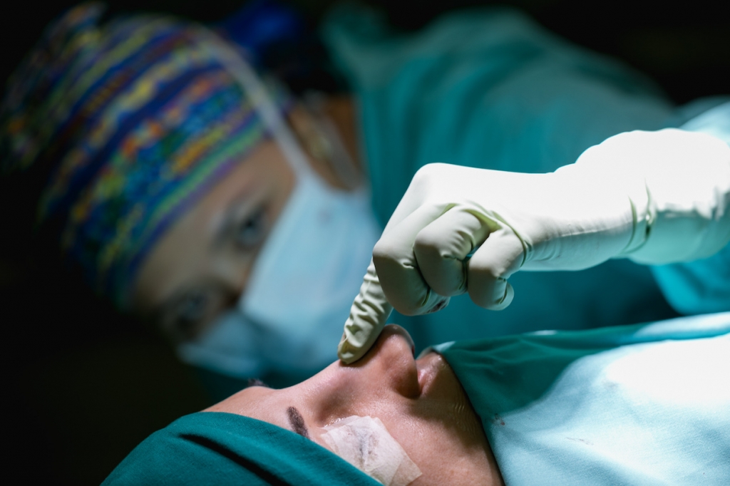 RINOPLASTIA SECUNDARIA LA CIRUG A A LA QUE SE HA SOMETIDO MAR A POMBO RINOPLASTIA SECUNDARIA LA CIRUG A A LA QUE SE HA SOMETIDO MAR A POMBO