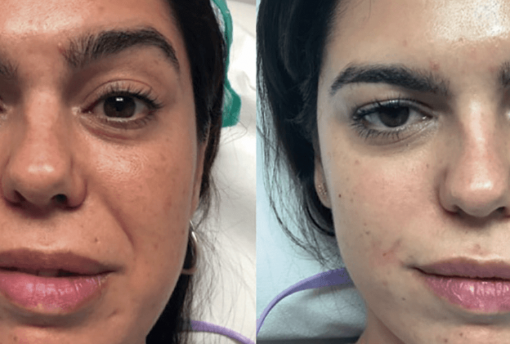 asimetrias faciales