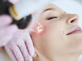 laser de picosegundos