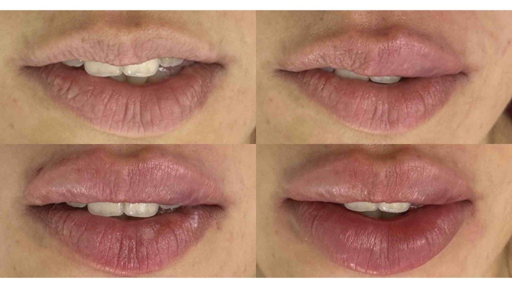 Labios que desafían el tiempo