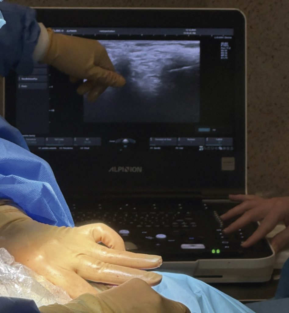 Rinoplastia ultrasónica