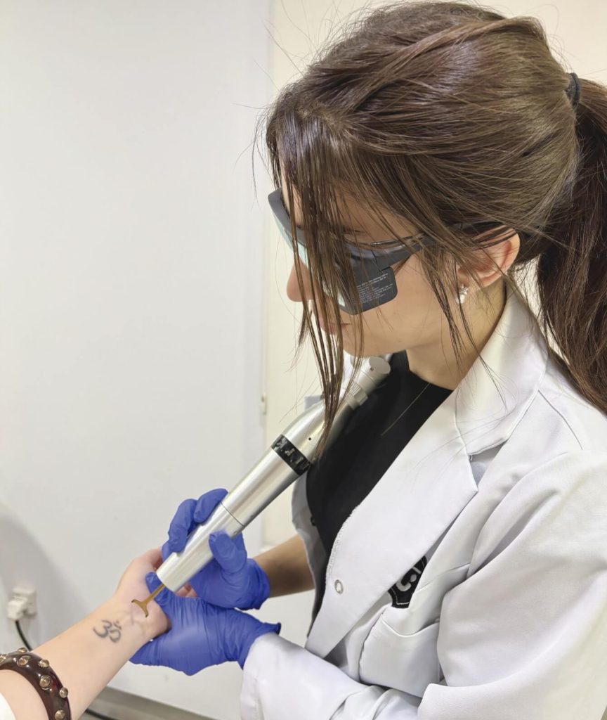 eliminación
de tatuajes con láser