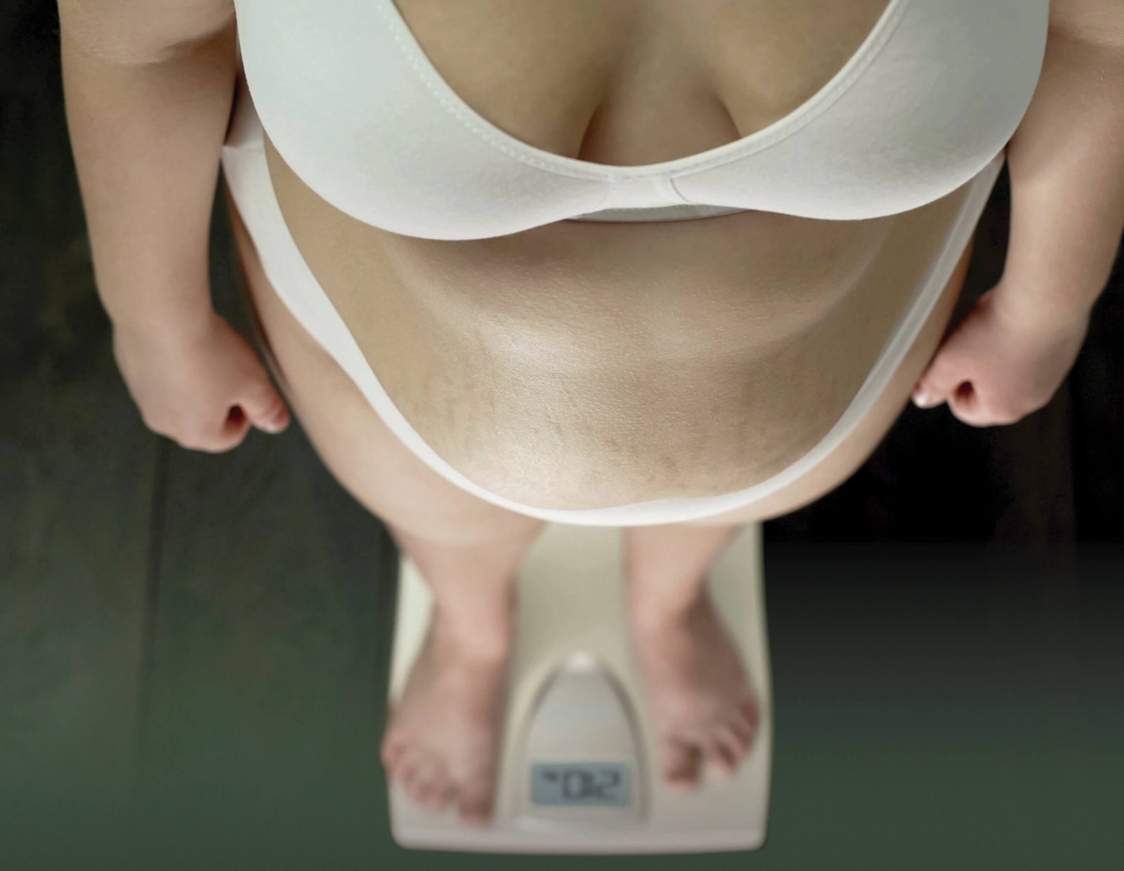sindrome metabolico