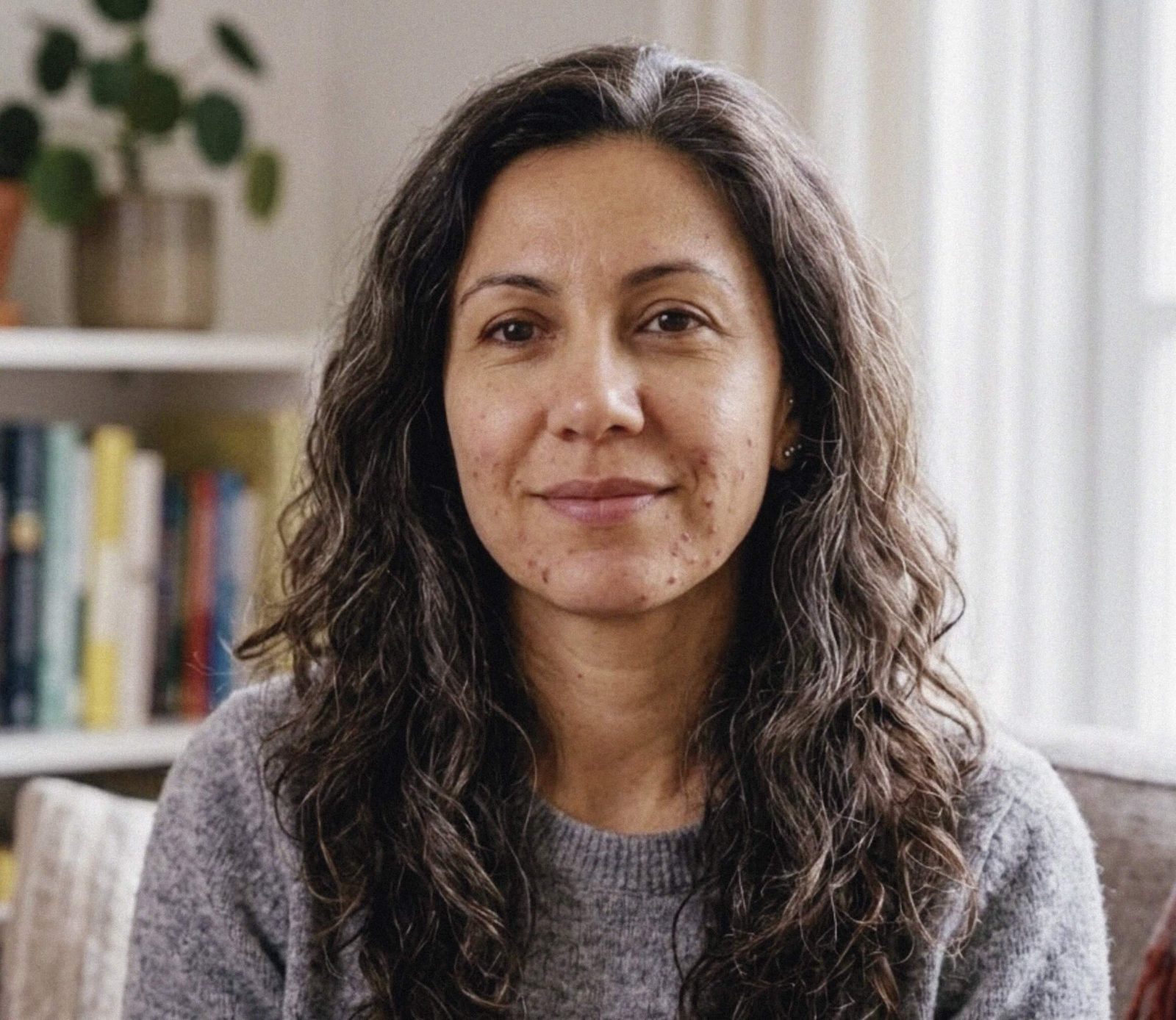 Acné de la mujer adulta
