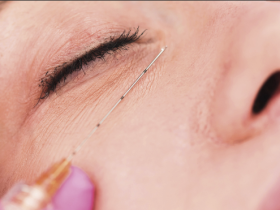 tiroiditis de Hashimoto