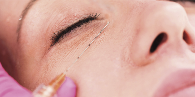 tiroiditis de Hashimoto