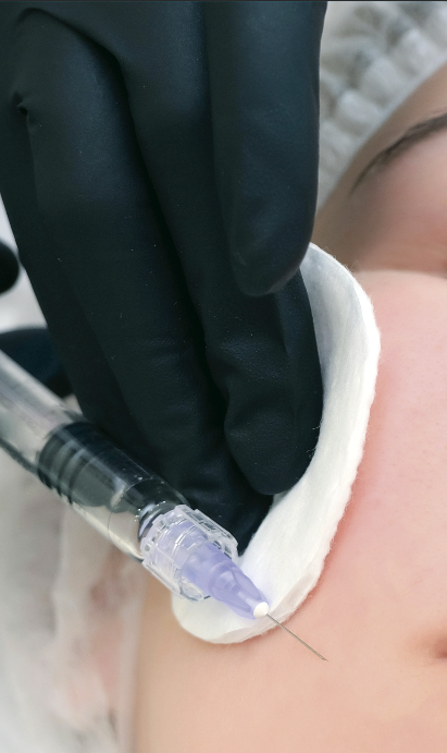 tiroiditis de Hashimoto