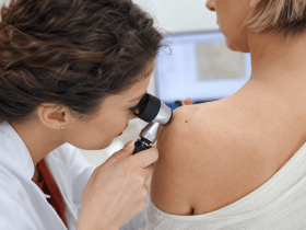 Dermatólogo revisando un lunar con dermatoscopio, vacuna del melanoma
